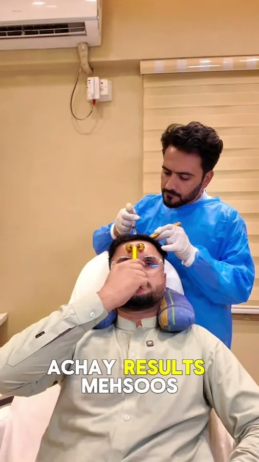 Hair fall and hair restoration