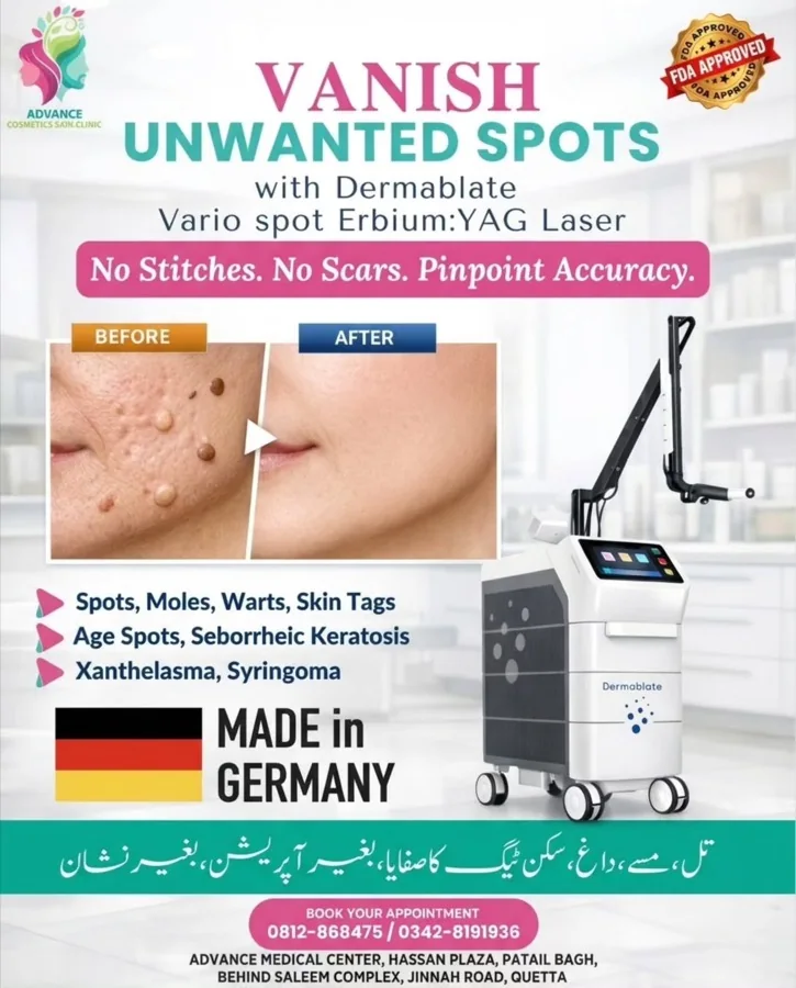 Pigmentation, melasma and freckles