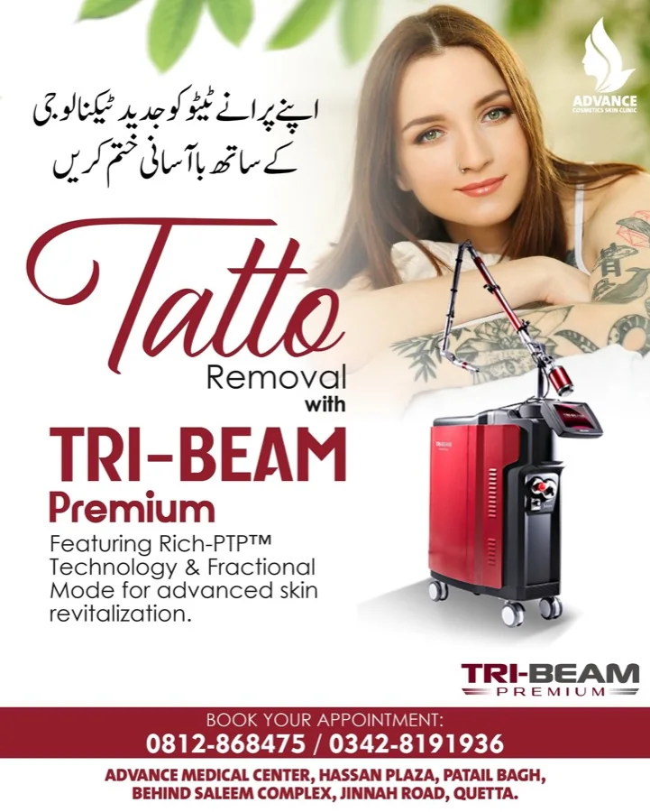 Tattoo removal